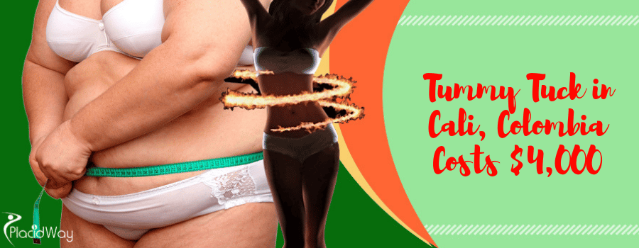 Cost of Tummy Tuck in Cali, Colombia